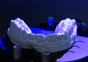 Dental wear